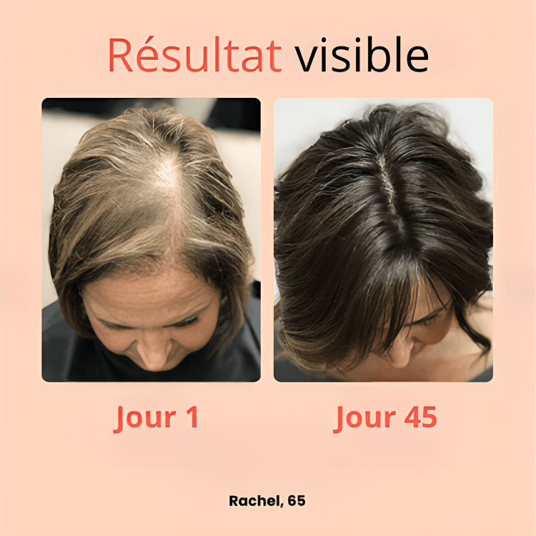 Revitaliseur Capillaire 3 - en - 1 avec Thérapie à Lumière Rouge - HairBloom