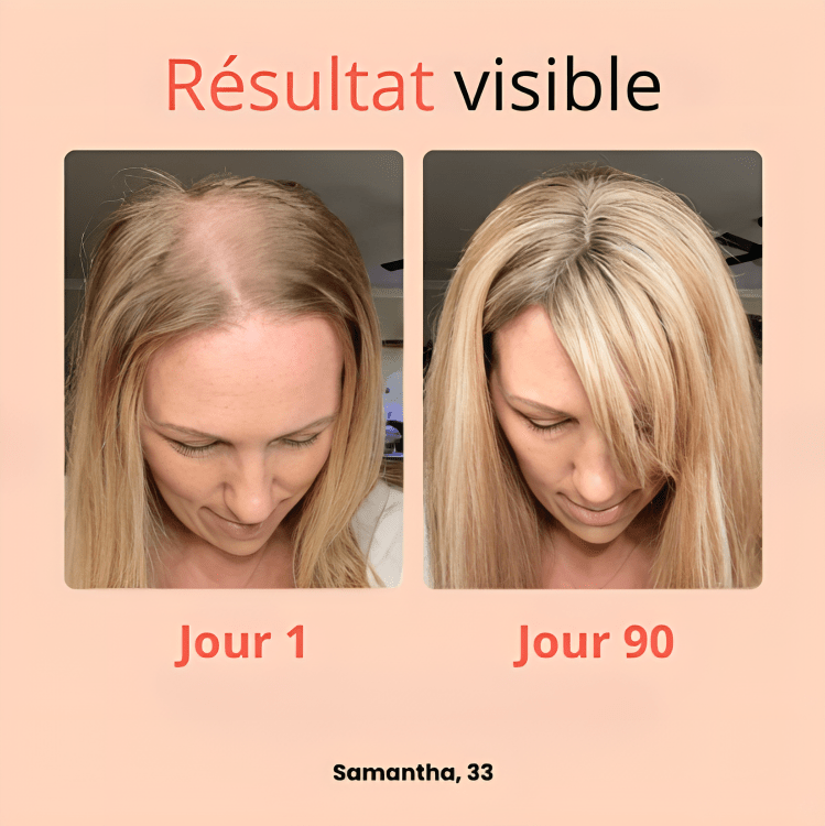 Revitaliseur Capillaire 3 - en - 1 avec Thérapie à Lumière Rouge - HairBloom